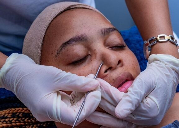 Why Facial Extractions Should Be Done Professionally