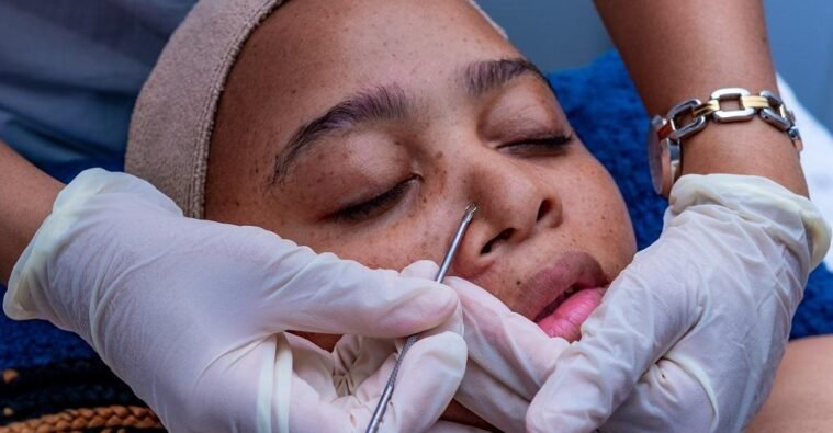 Why Facial Extractions Should Be Done Professionally
